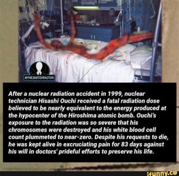 The Real History Of Hisashi Ouchi: A Tragic Tale Of Radiation Exposure